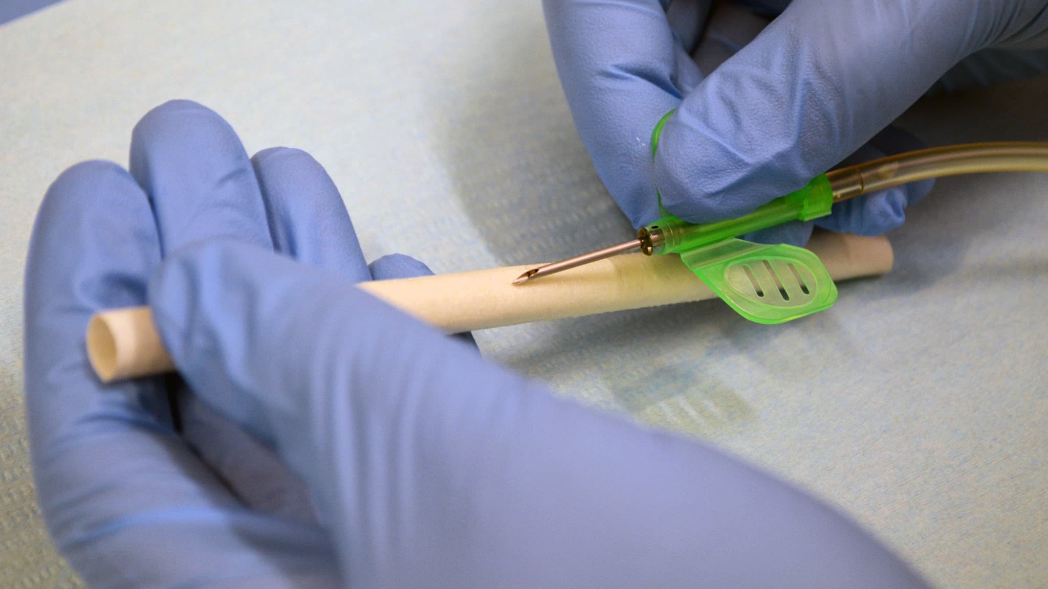 Dialybrid Silkothane Graft